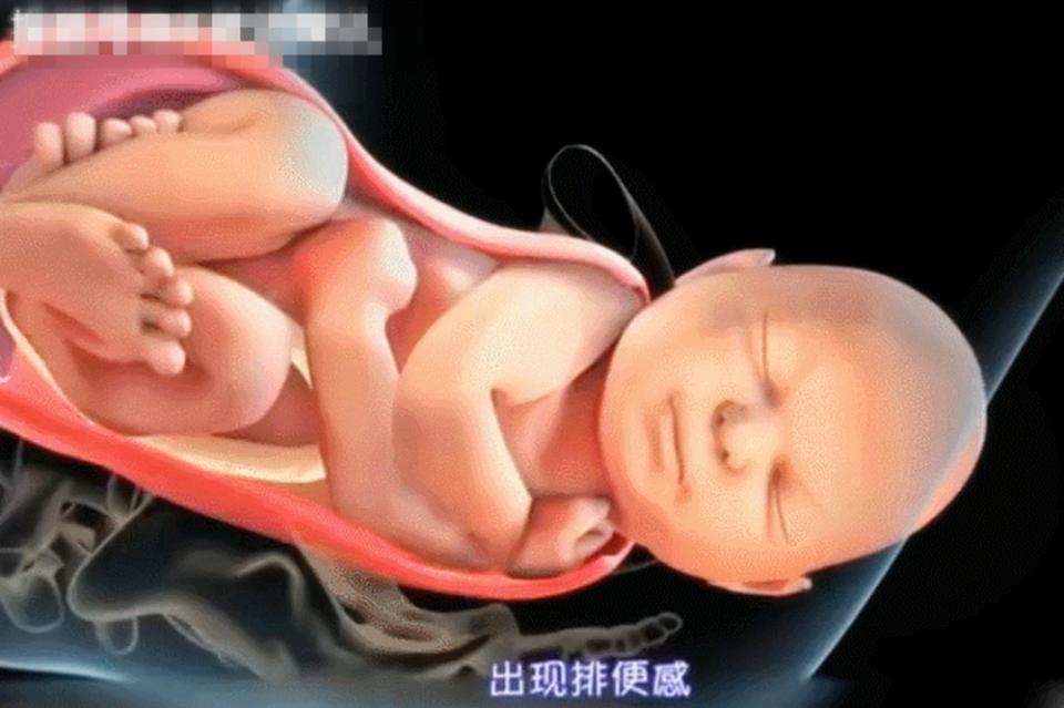 女性隐私部位“松弛”,影响夫妻感情,可能与这“1少1多”有关