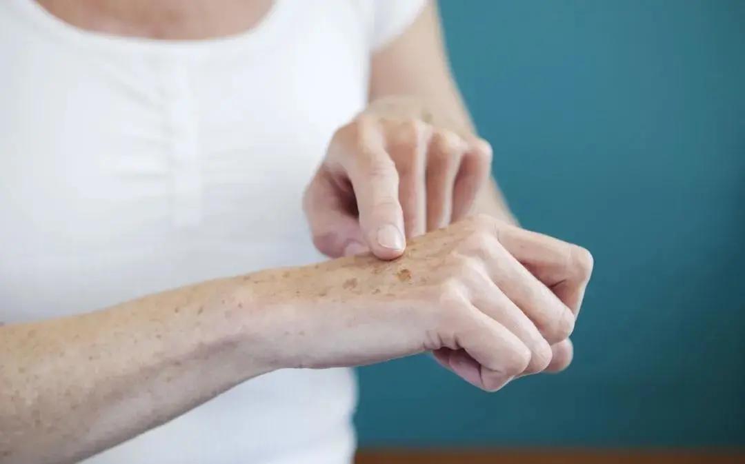 别踩雷了看看这些美妆雷区,淡斑美白踩雷