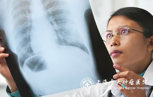 癌症患者疲劳是什么原因,癌症患者易疲倦怎么办