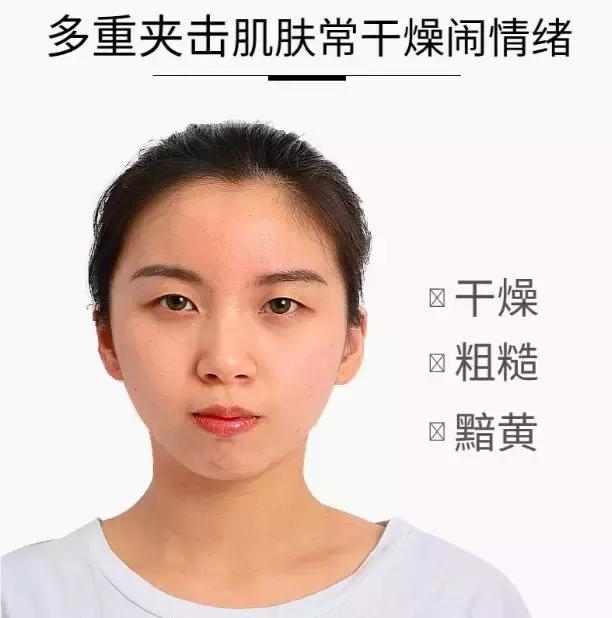 打完水光10天还是很多疙瘩,打完水光后的后遗症