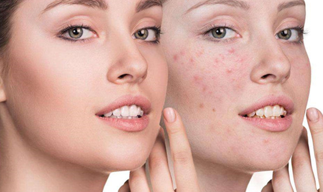 不同价格的气垫,各品牌气垫测评