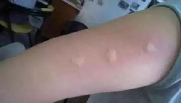 日本的变态杀蚊子神器,日本蚊子驱蚊神器