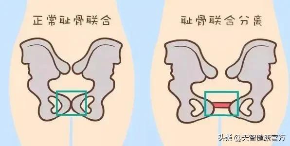 产后妈妈难以言说的痛：新生命的到来带来了欢乐，还带来了尿*禁失**