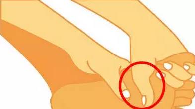 扁平足穿没有足底支撑的鞋,如何改善扁平足穿鞋的效果