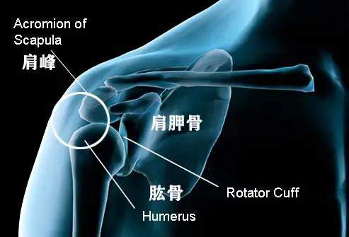 肩膀疼痛要警惕的三种病怎么治疗,肩膀疼痛要警惕的病怎么治疗