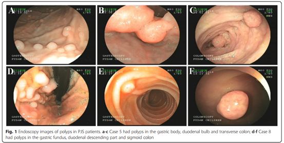 母亲嘴唇有黑斑遗传给孩子的概率,小孩嘴唇黑有什么病