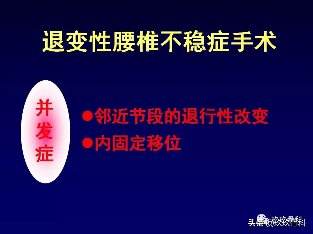 腰椎不稳最坏的结果,腰椎不稳的最佳治疗方法