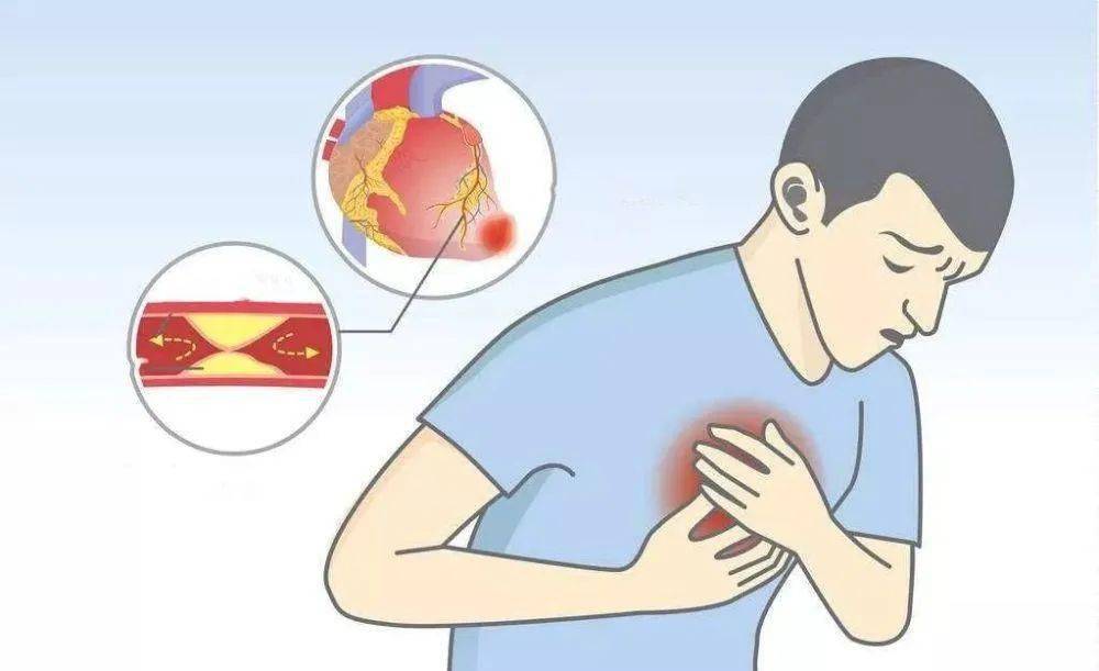 这几种疼痛竟预示着心梗,闻所未闻的病