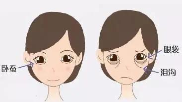 卧蚕整形可以去眼袋吗,眼袋和卧蚕整形前后对比