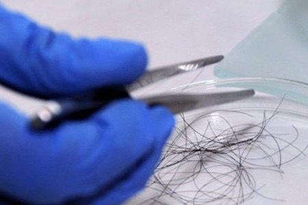 男子器官移植后9个月死亡,美国男子做移植手术