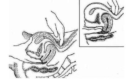 子宫“问题百出”,妇科检查到底做哪些?