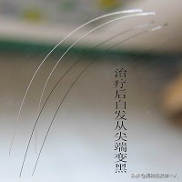 为什么会流清鼻涕,为什么会流清鼻涕和眼泪