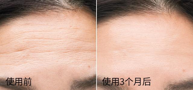 越敷越白胶原蛋白面膜,越敷皮肤越嫩的泥膜