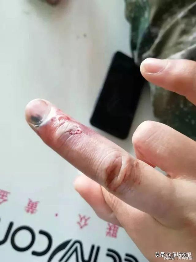 疫情期间你熬得住吗 (如果疫情再下去你能熬多久)