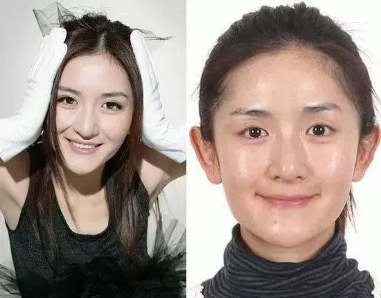 左右脸不对称怎么自我矫正,左右脸严重不对称及时调整体态