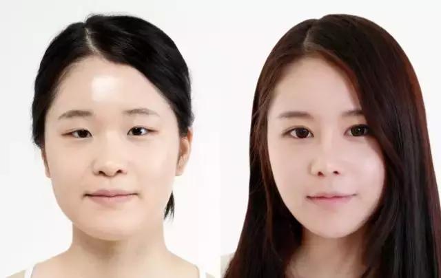 网红眼睛开眼角,做过开眼角的网红