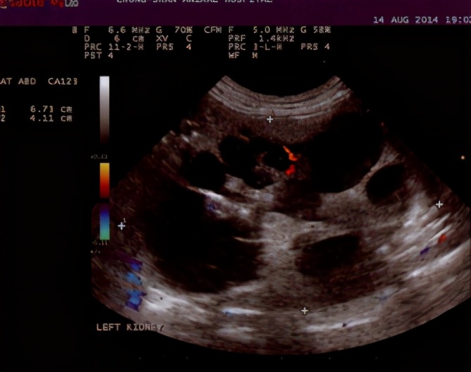 猫得多囊肾特效药,猫多囊肾最多活几年