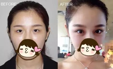 angelababy的容貌变化,angelababy变美过程