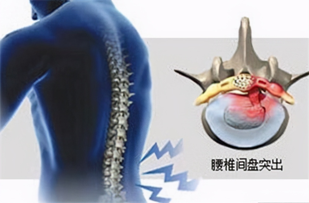 铁腰板青岛伍龙生物科技,青岛伍龙铁腰板