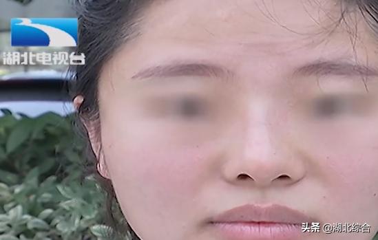孕妈花高价垫鼻梁，不料术后歪成“蛇精脸”，医院：最多退4000