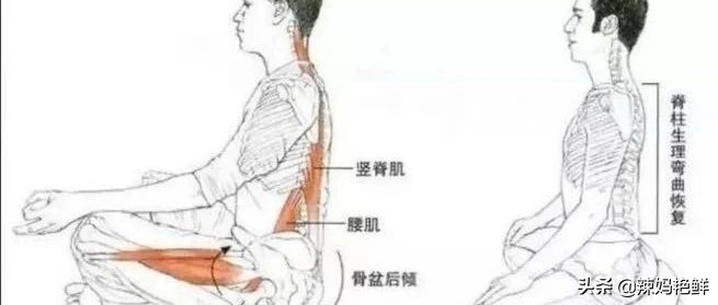 看起来驼背的几种情况,驼背后背中间驼怎么矫正