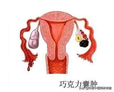 中医促排卵汤，辩证运用，多囊卵巢综合征也可以怀孕。