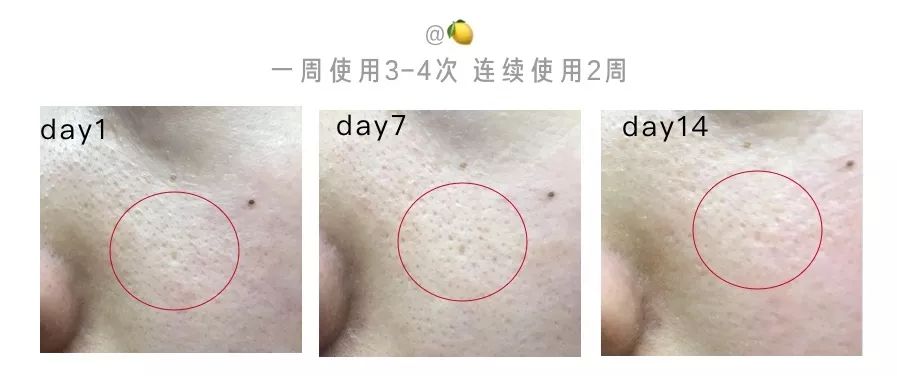 好用的毛孔收敛产品,收敛水收缩毛孔推荐真实