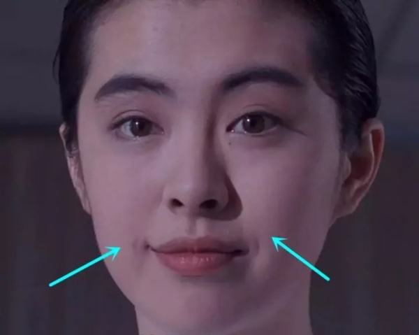 嘴凸法令纹怎么修容,嘴凸法令纹怎么消除学生党