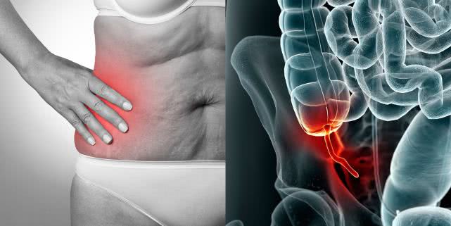 肚脐眼疼的原因已找到，十有八九，和这4种病有关系