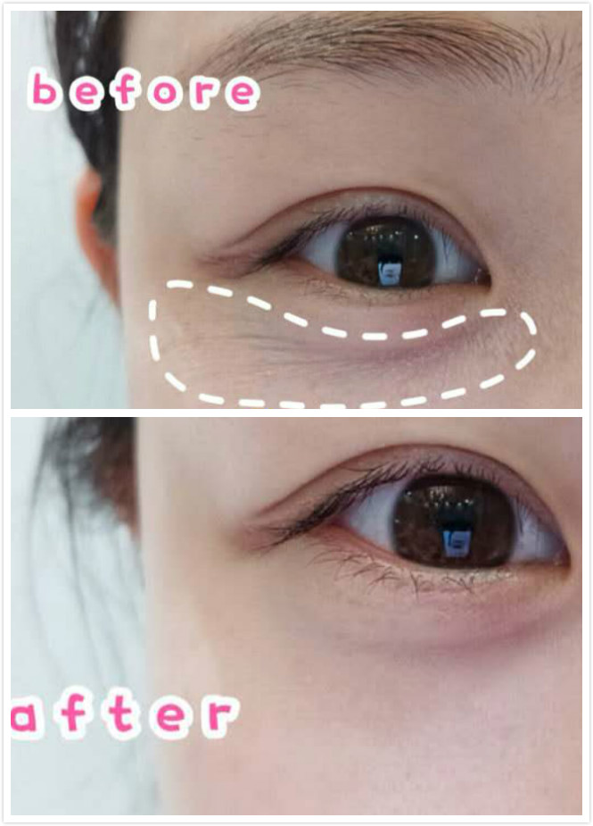 欧阳娜娜和周冬雨是什么关系,28岁的周冬雨图片