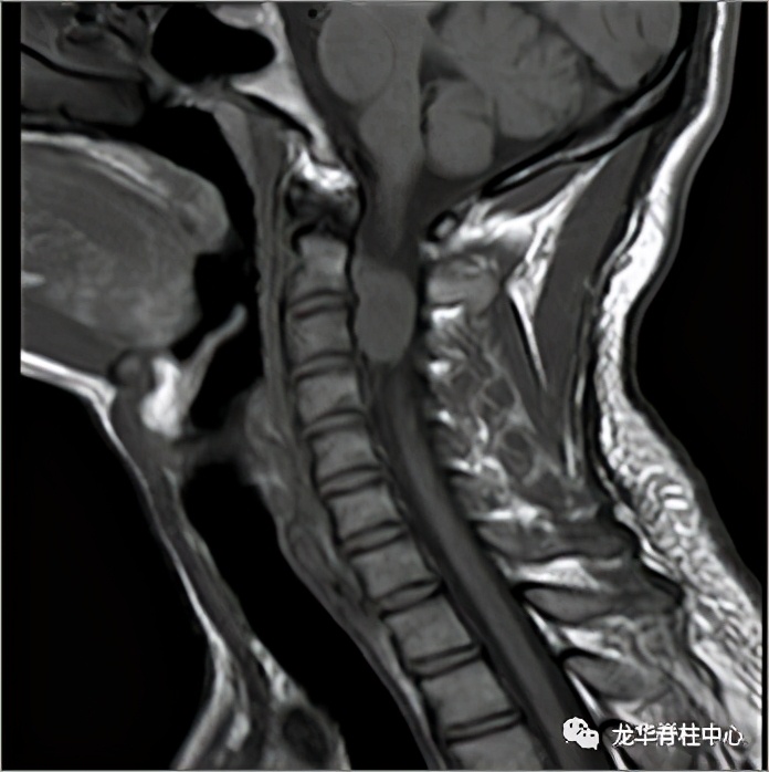 深圳市龙华区人民医院脊柱外科简介