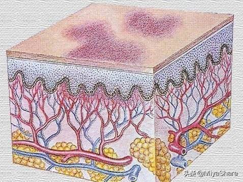 油性皮肤适合天天敷面膜吗,皮肤干怎么敷面膜效果好