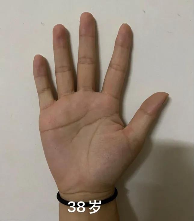 手诊看身体状况准吗,手诊手指看健康