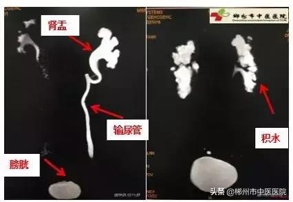 磁共振检查对身体有害吗,医院磁共振是检查什么的