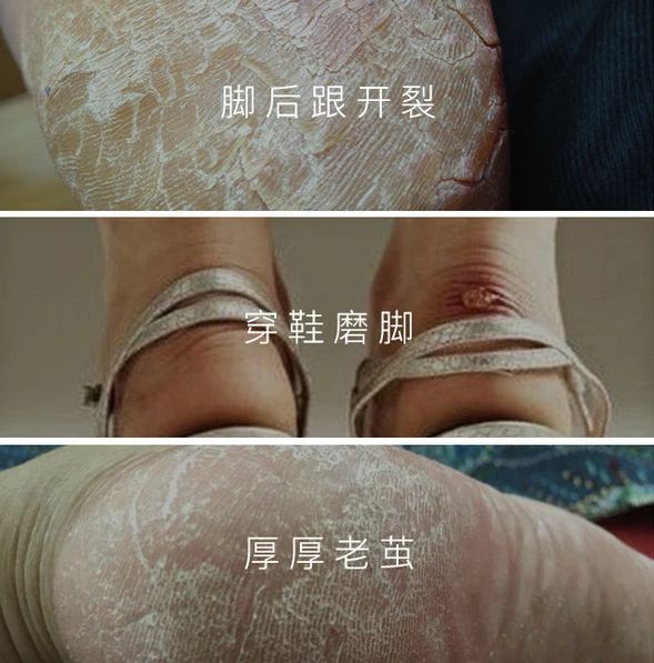 40岁秦岚的腿,秦岚四十岁的少女感