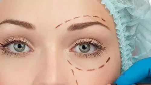 祛除大眼袋黑眼圈皱纹色斑痘痘,怎样祛除黑眼圈眼袋的方法