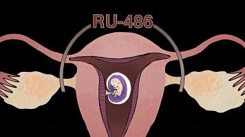 25岁的女生有几次打胎,女子堕胎6次连医生都惊讶了