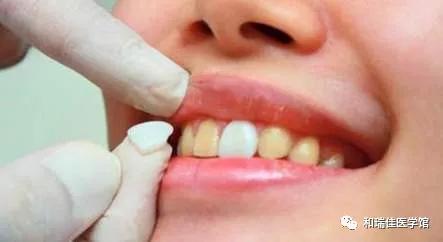 牙齿美容未来的趋势,牙齿美容这个项目前景如何