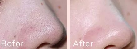 好皮肤怎么样养成的,好脸蛋