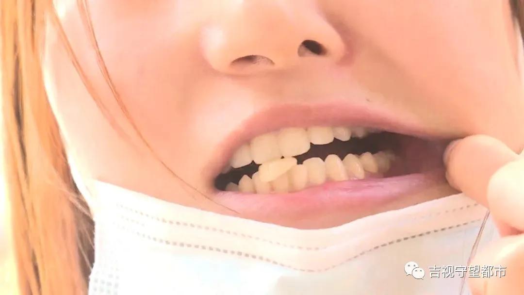 长春市超龙牙博士口腔,牙博士口腔烤瓷牙多少钱