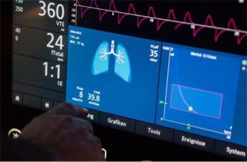 呼吸机是不是完全国产化,中国呼吸机