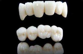 根管治疗后牙冠一般用什么材质,一般什么样才需要做牙冠