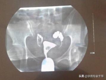 助孕专家于萍,青岛专家于萍简介