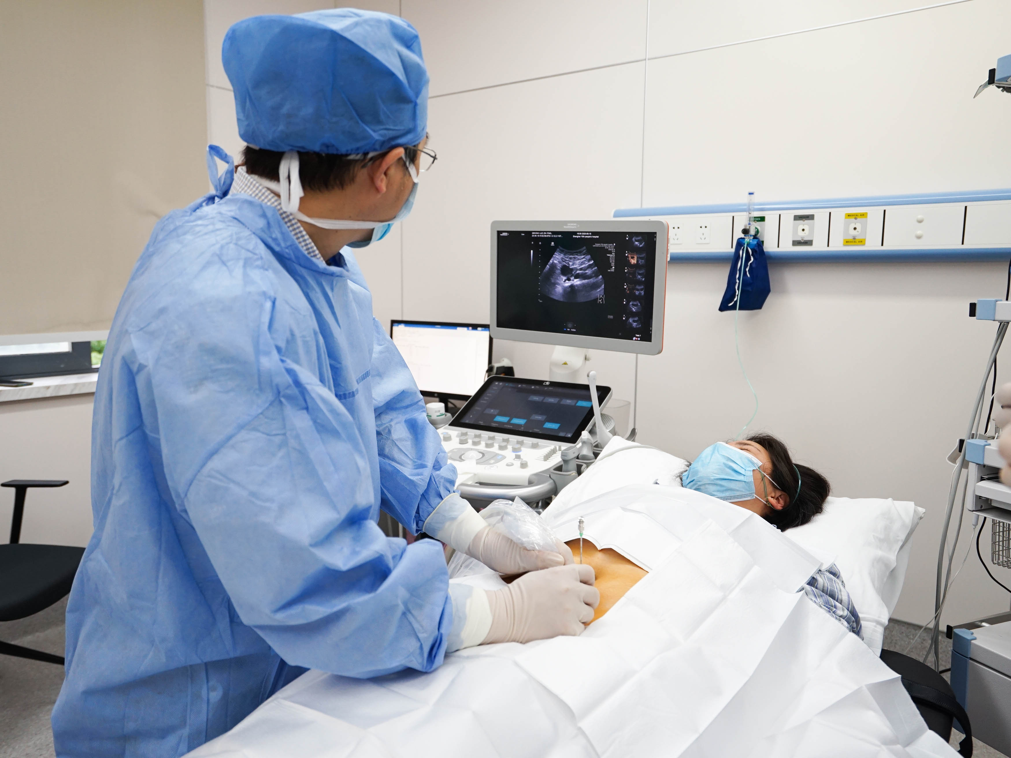 每25名育龄女性就有1名巧囊患者，规范巧囊超声介入治疗，上海十院牵头制定专家共识