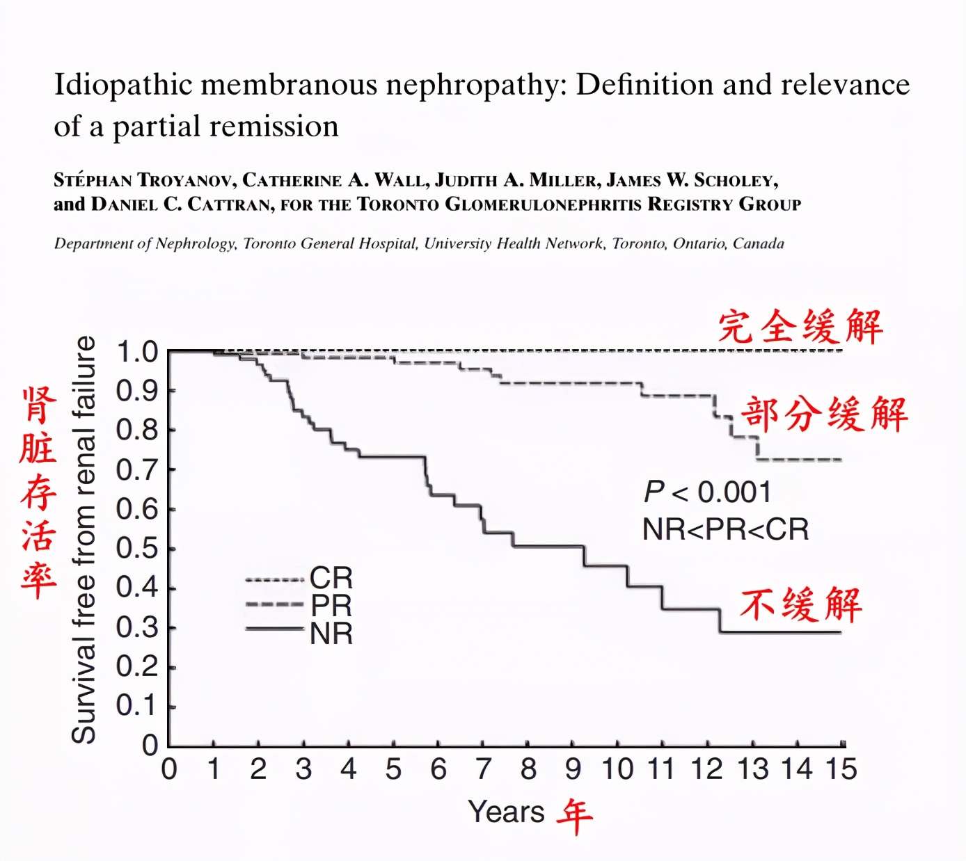 膜性肾病到底需不需要忌口,膜性肾病科普视频