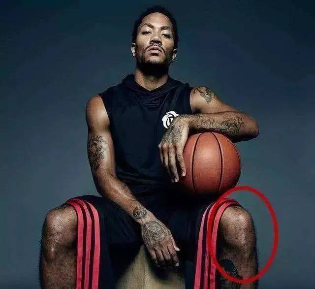 罗斯的脚趾,罗斯的膝盖是怎么样的