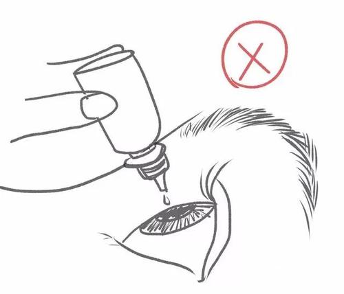 眼科滴眼药水操作流程,眼科用药滴眼液