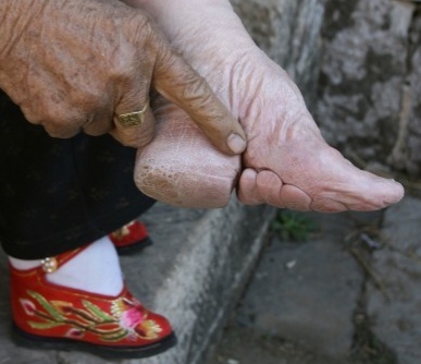 老年人的鞋不跟脚,老年人穿鞋脚疼不穿鞋是关键