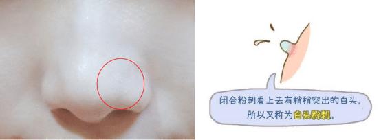 去白头的全部过程,去白头最好方法