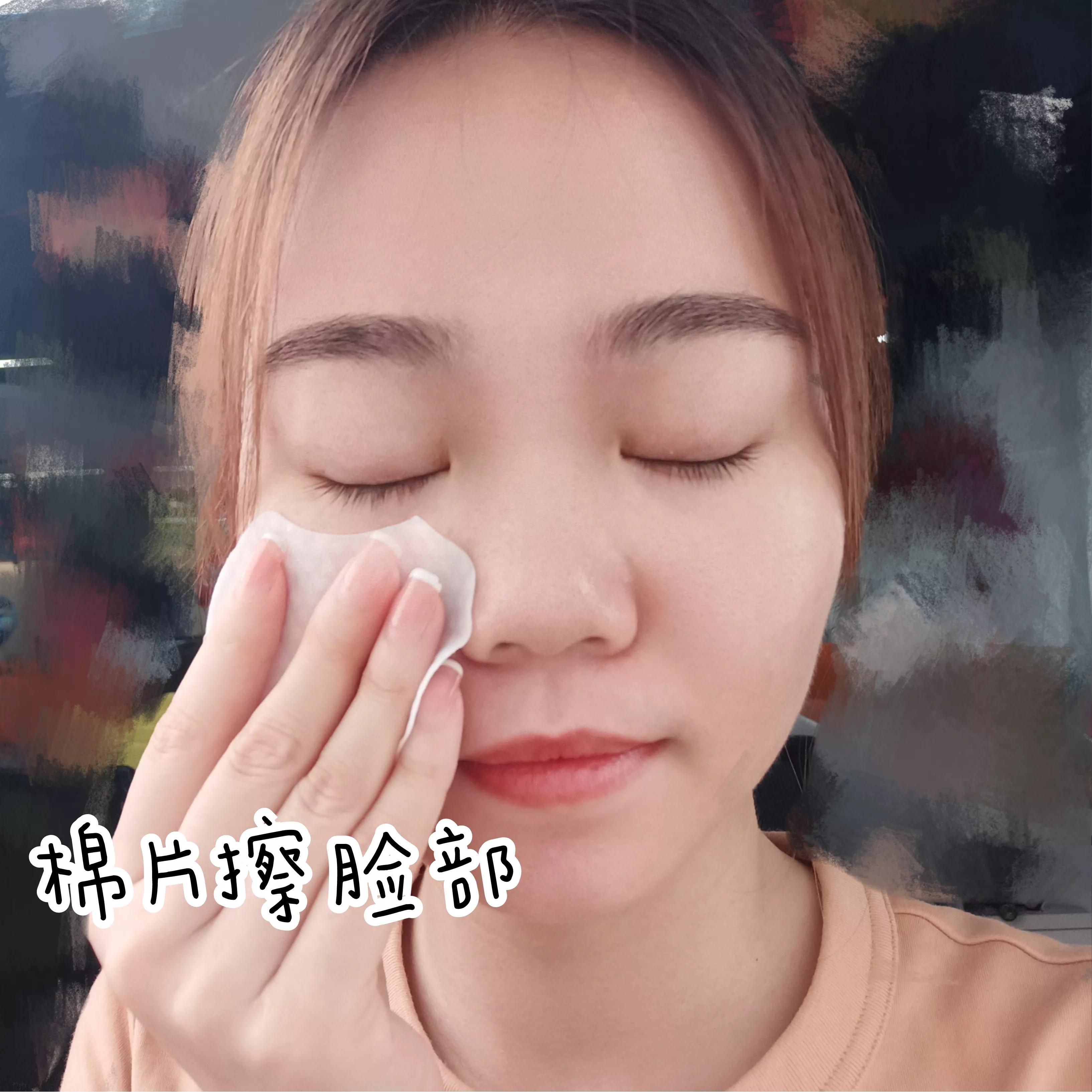 刷酸烂脸的小妙招,刷酸害怕爆皮怎么办